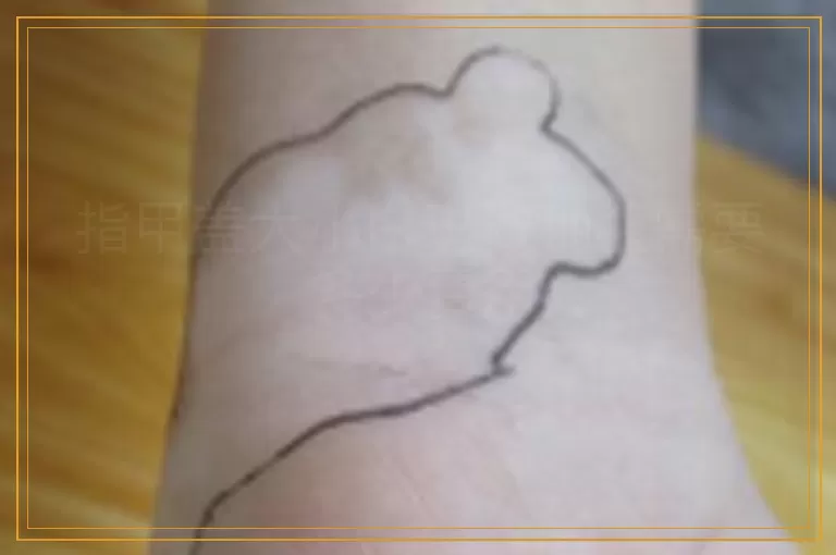 指甲盖大小白斑做种植需要多少费用