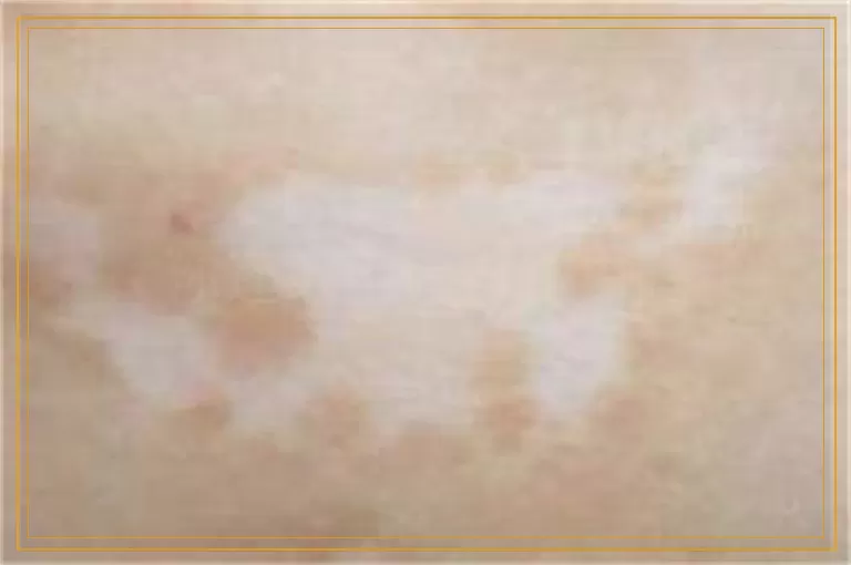 你还敢用偏方祛白吗