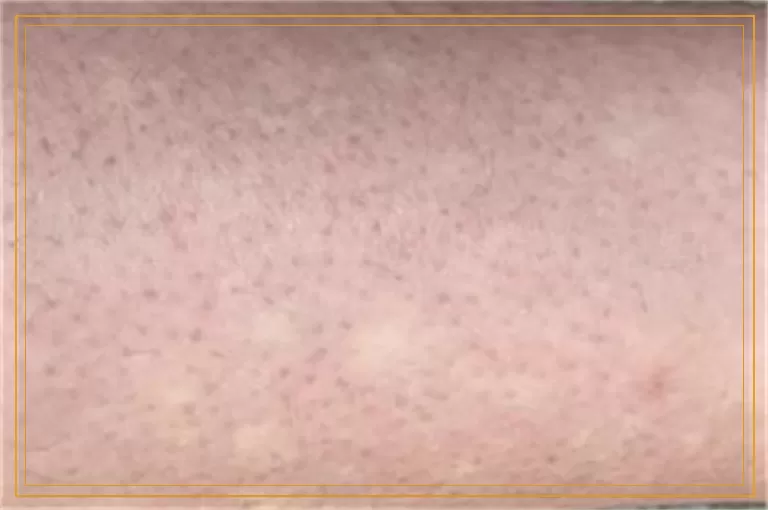 儿童脸蛋白一块是怎么回事