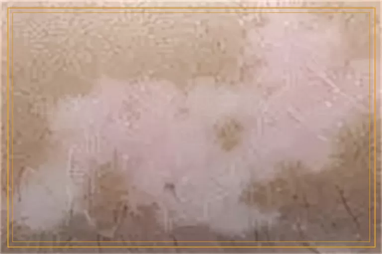 白癜风为什么越来越多 谁之过