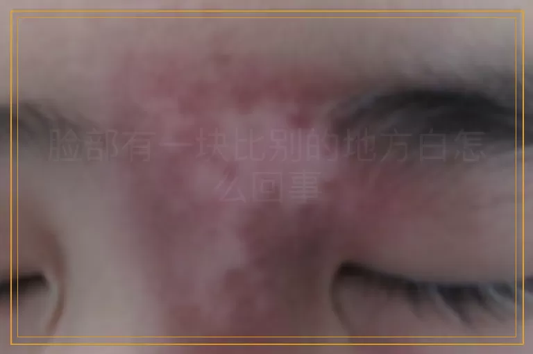 脸部有一块比别的地方白怎么回事