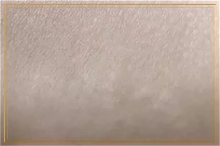 眼睛周围长白癜风吃什么药