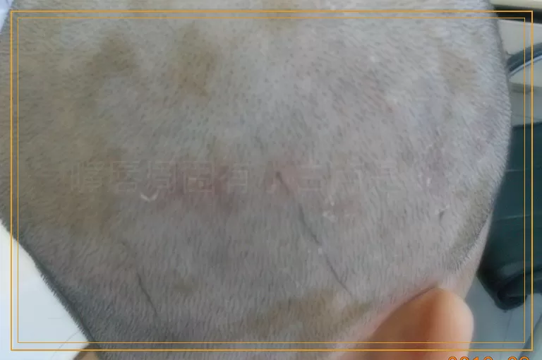 嘴唇周围有小白点是什么