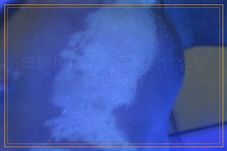 白癜风抹了他克莫司什么感觉也没有