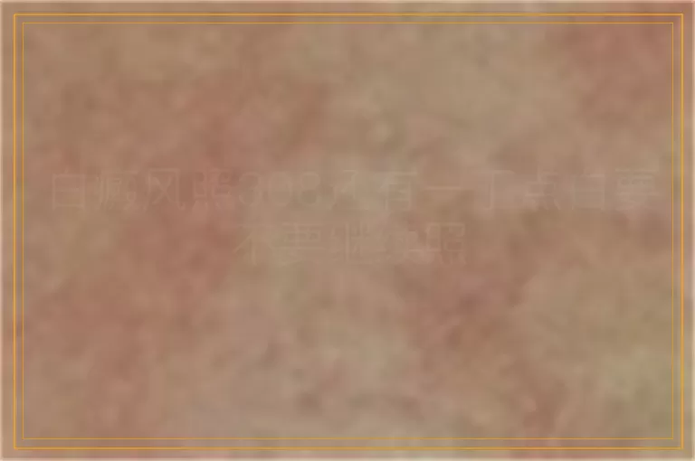 白癜风照308还有一丁点白要不要继续照
