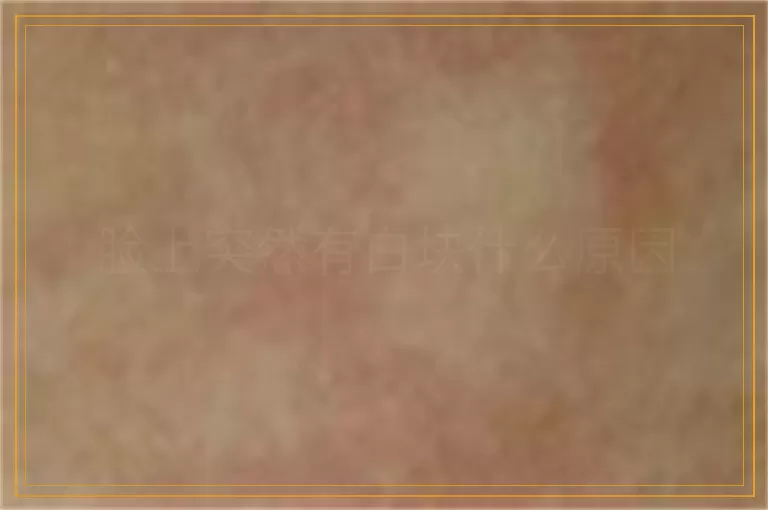 脸上突然有白块什么原因
