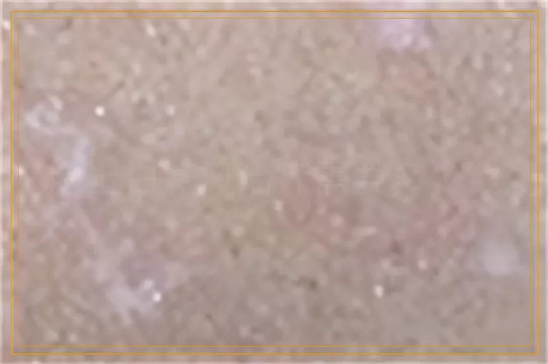 脸上白癜风治疗需要多少钱