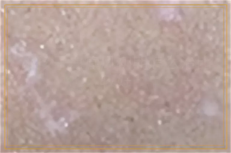 小孩子白癜风初期怎么治比较好