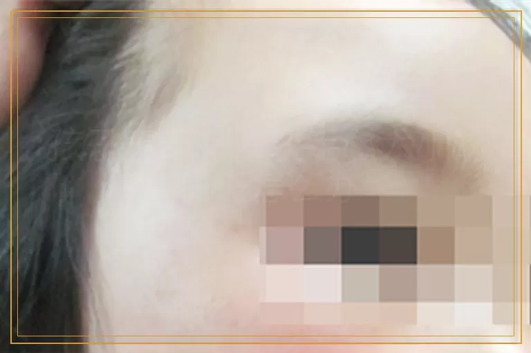 孩子腹部有一块手心大小的白斑怎么办