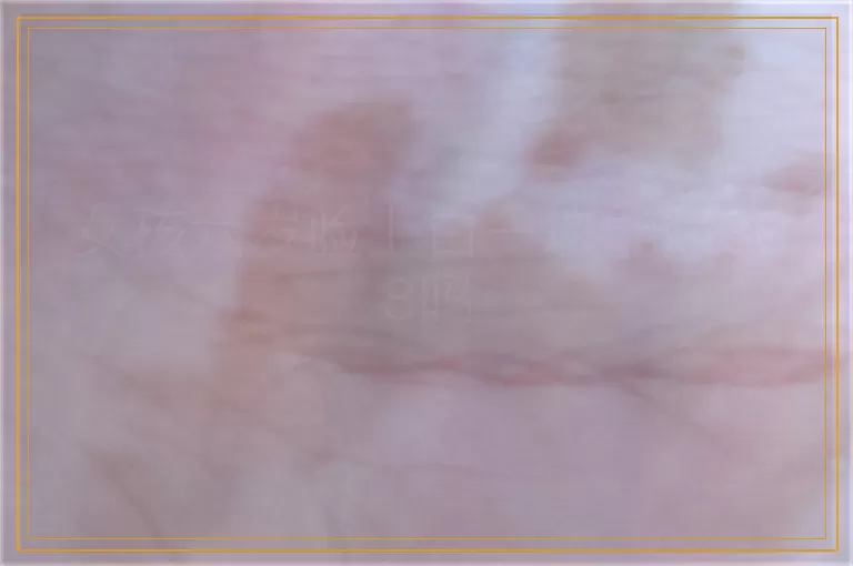 女孩六岁脸上白一块能照308吗