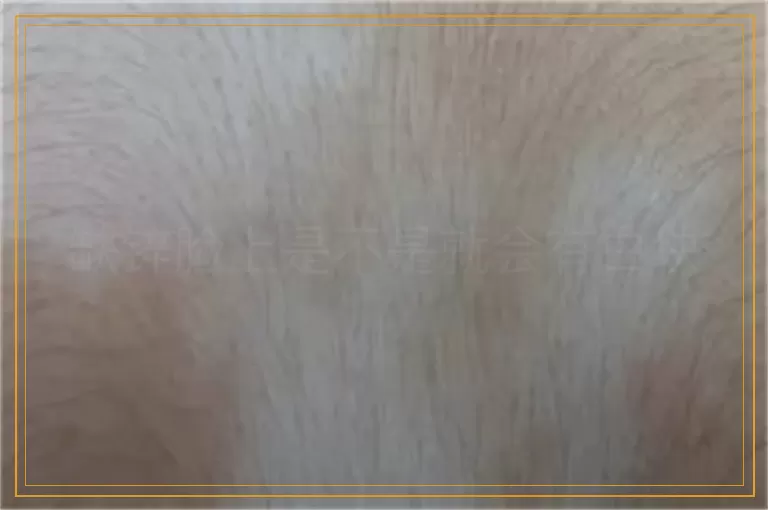 缺锌脸上是不是就会有白块