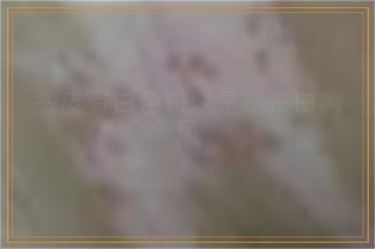 头皮有白色斑块是不是白癜风