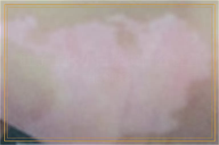 肚子上长小白块做什么检查能确诊