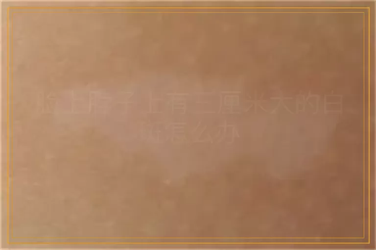脸上脖子上有三厘米大的白斑怎么办