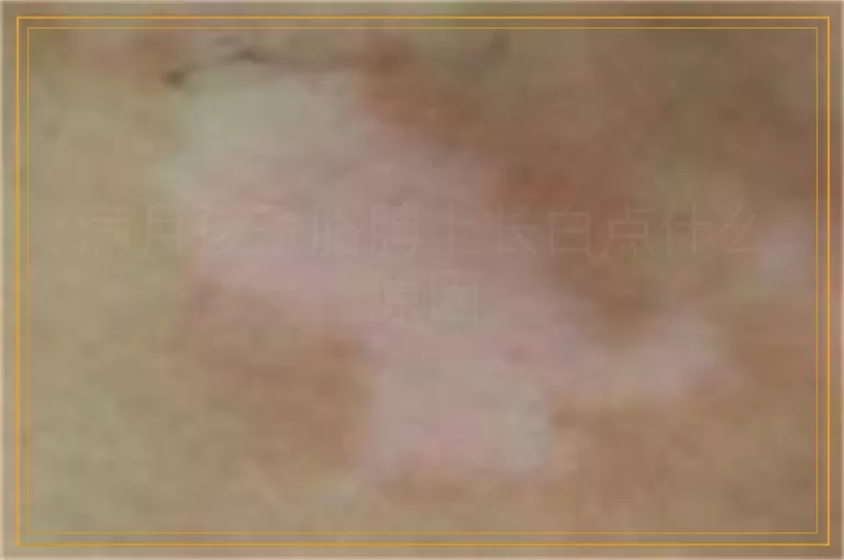 满月孩子胳膊上长白点什么原因