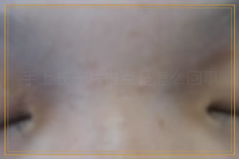 手上长一片白点是怎么回事