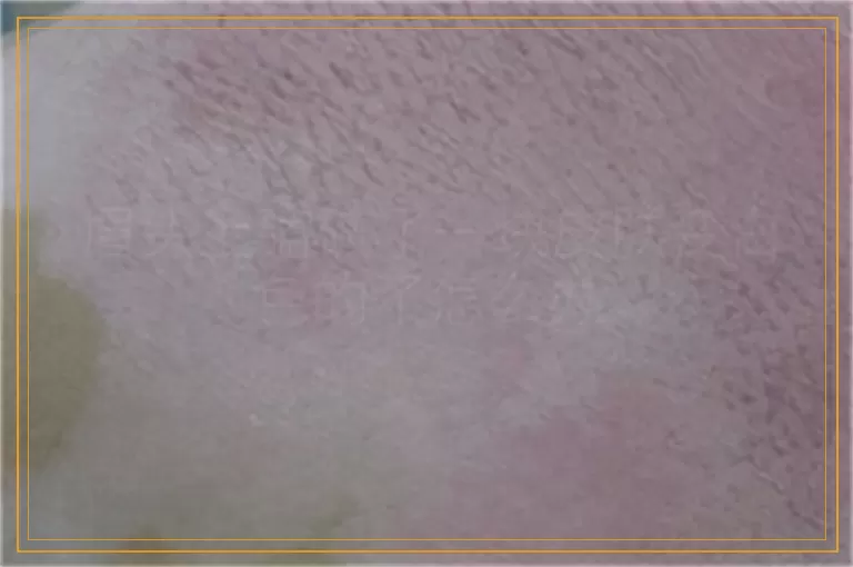眉头上磕破了一块皮肤变白色的了怎么办