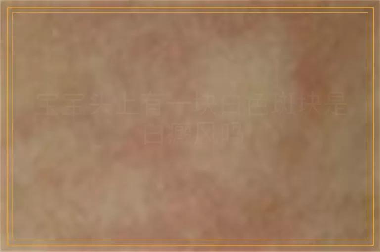 宝宝头上有一块白色斑块是白癜风吗