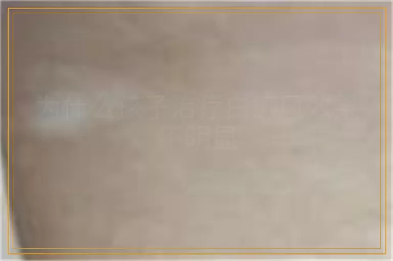为什么孩子治疗白癜风效果不明显