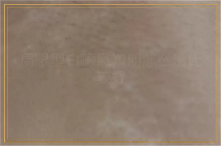 局限型白癜风初期怎么治比较好