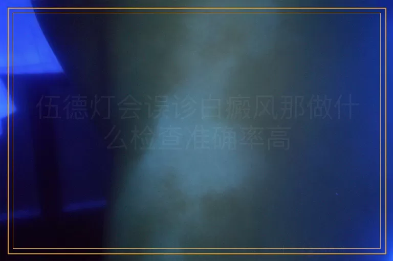 伍德灯会误诊白癜风那做什么检查准确率高