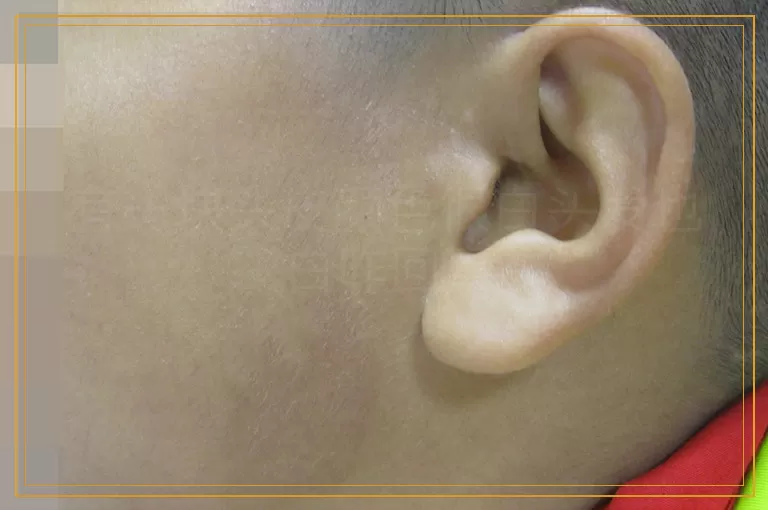 有一块头皮颜色很白头发也白咋回事