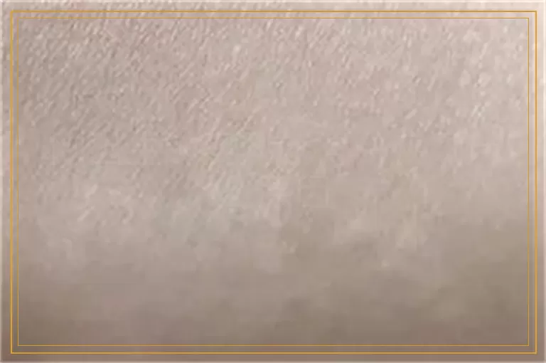 刚出生的婴儿就得白癜风什么原因