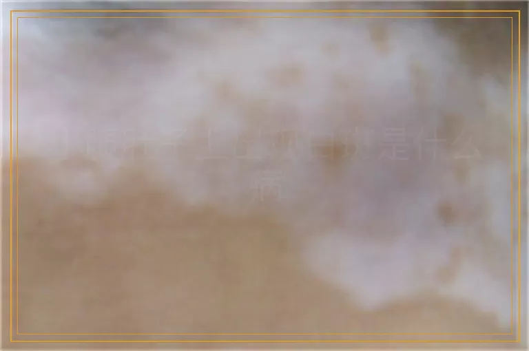 小腿肚子上出现白斑是什么病