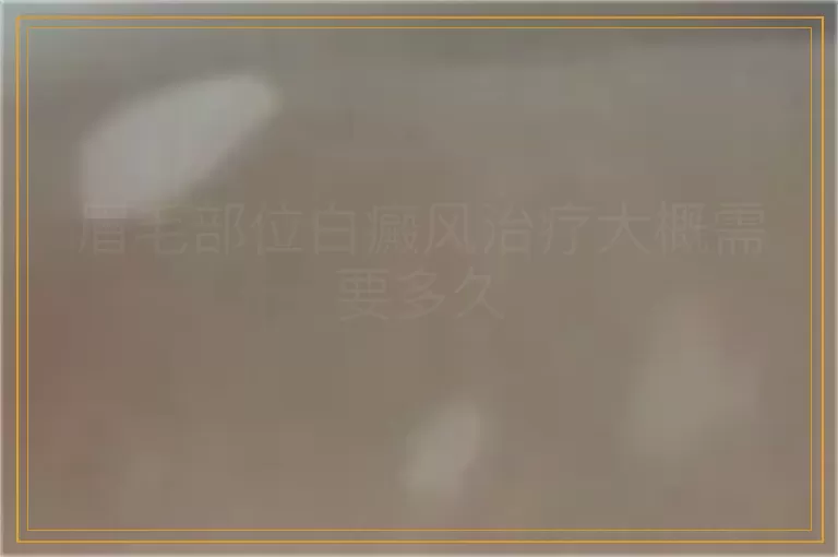 眉毛部位白癜风治疗大概需要多久