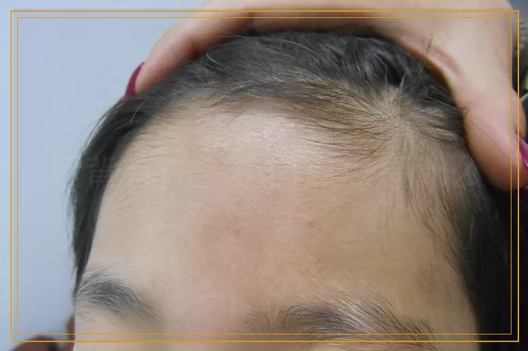 后背有许多小白点点是什么