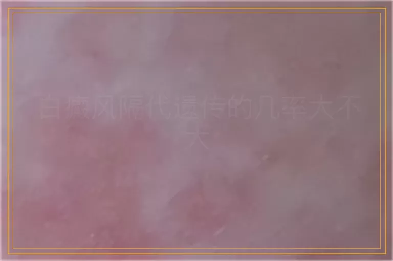 白癜风隔代遗传的几率大不大