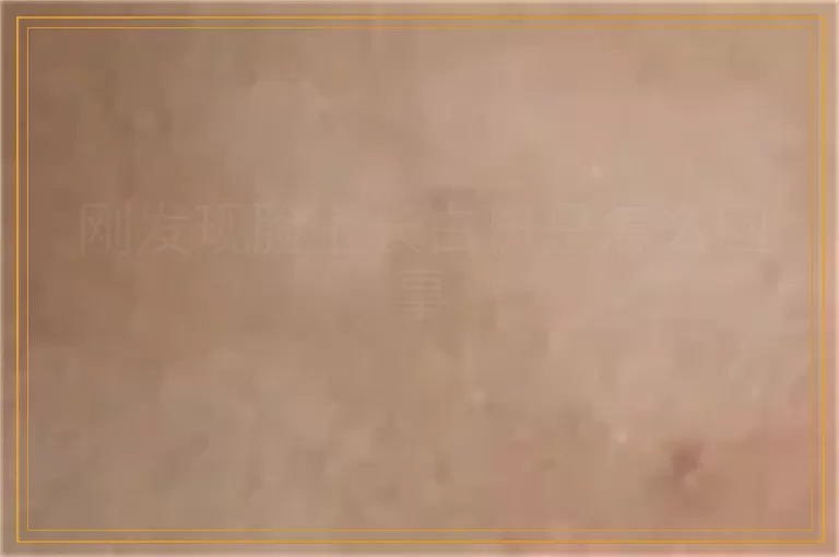 刚发现脸上长白斑是怎么回事