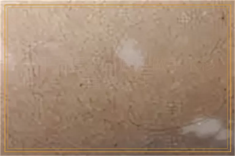 一平方厘米白癜风做手术移植多少钱