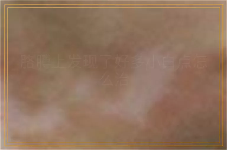 胳膊上发现了好多小白点怎么治