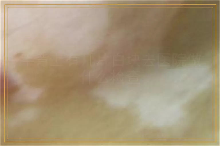 手背上有几片白块去医院做什么检查