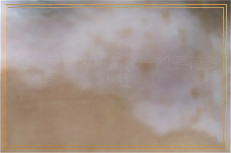 白癜风照308激光一般要花多少钱