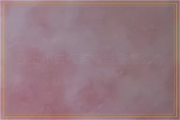 身上小白点越来越多怎么办
