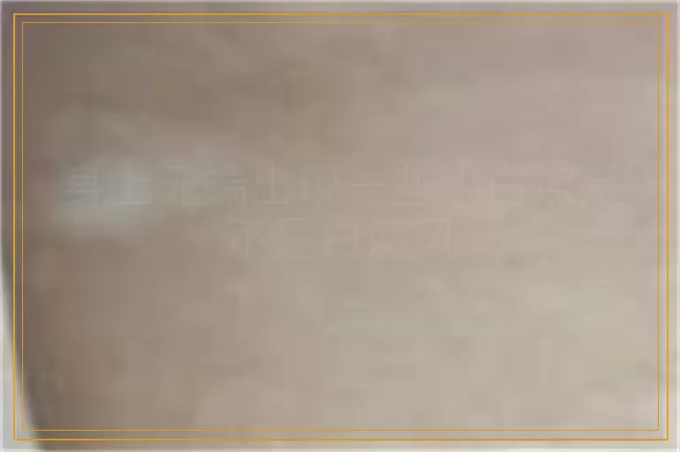 身上无端出现一些小白点是不是白癜风