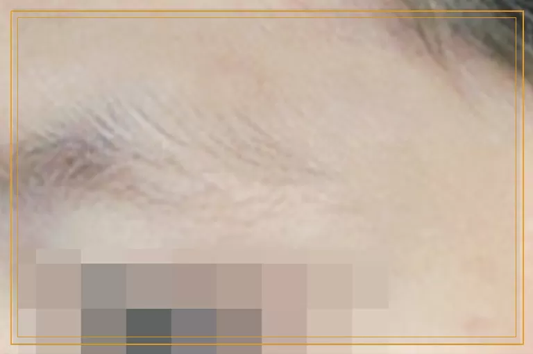 双腿和后背长白癜风怎么治疗好的快