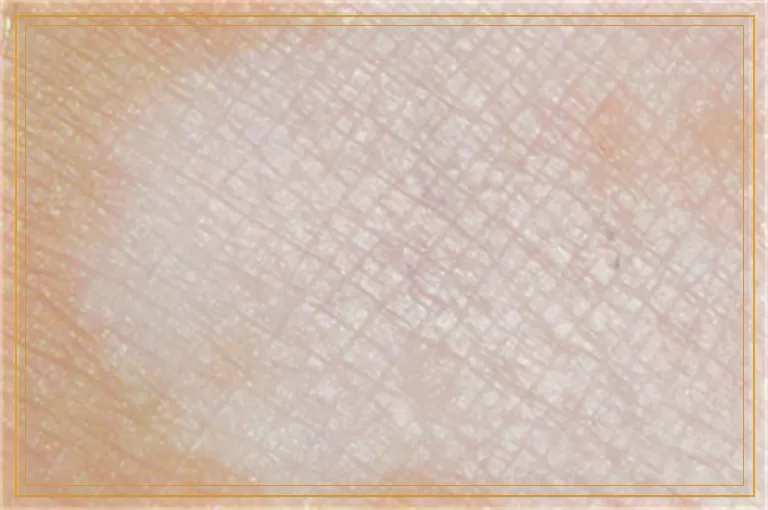 胳膊上有一块淡白色的斑怎么回事