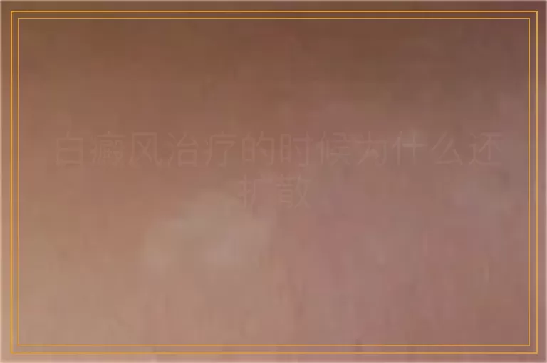 白癜风治疗的时候为什么还扩散