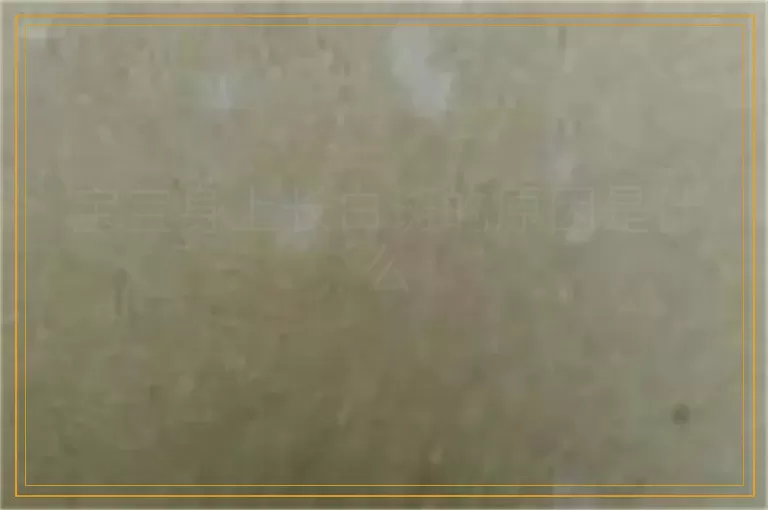 宝宝身上长白斑的原因是什么