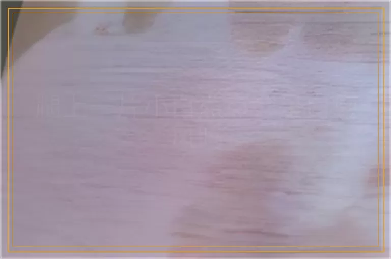 腿上一片小白点点会是白癜风吗