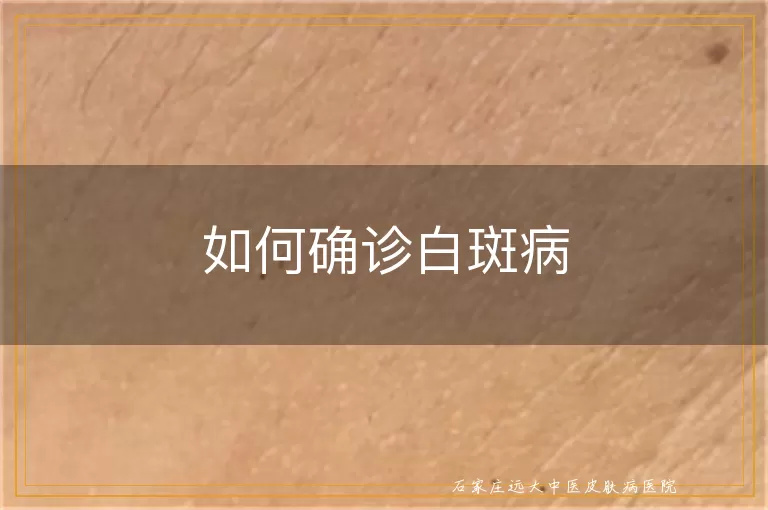 如何确诊白斑病