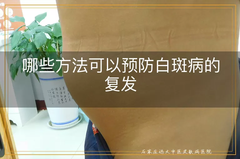 哪些方法可以预防白斑病的复发