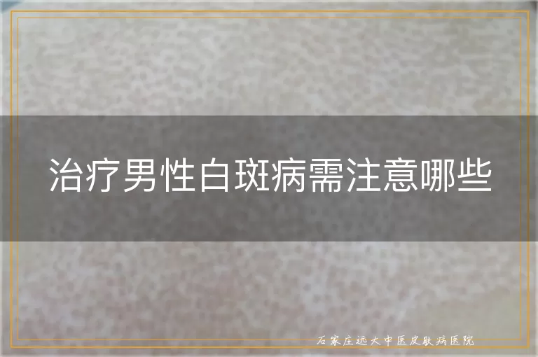 治疗男性白斑病需注意哪些