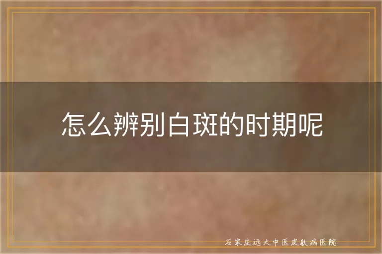 怎么辨别白斑的时期呢