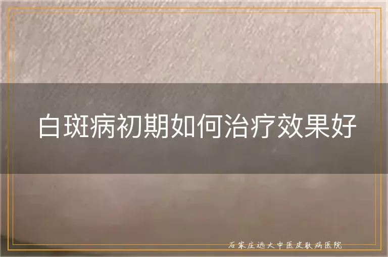 白斑病初期如何治疗效果好