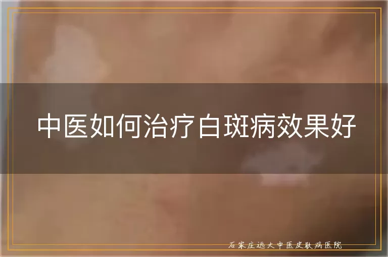 中医如何治疗白斑病效果好