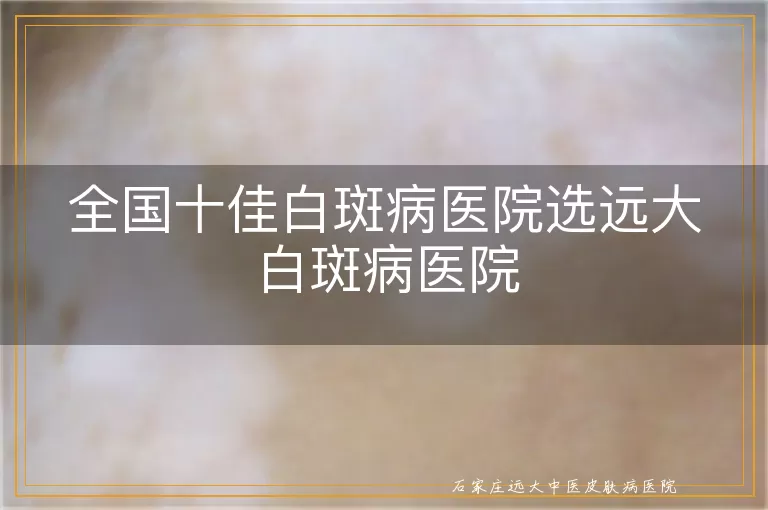 全国十佳白斑病医院选远大白斑病医院